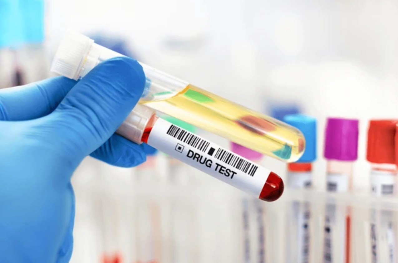Drugstest bij een rijbewijskeuring